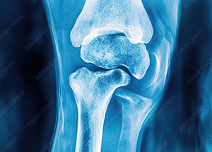 Sports Injuries & Arthroscopy image